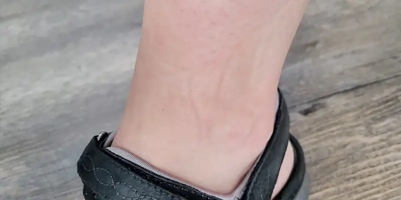 How to Get Rid of Sock Marks on Legs